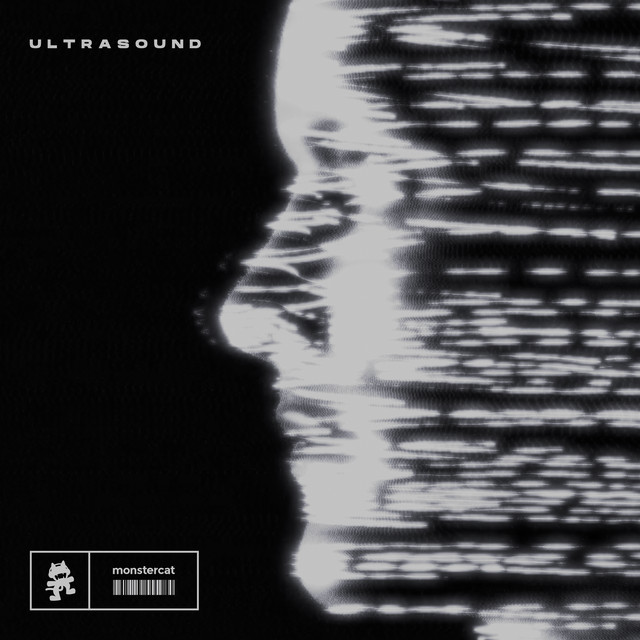 Arcando & Pirapus - Ultrasound